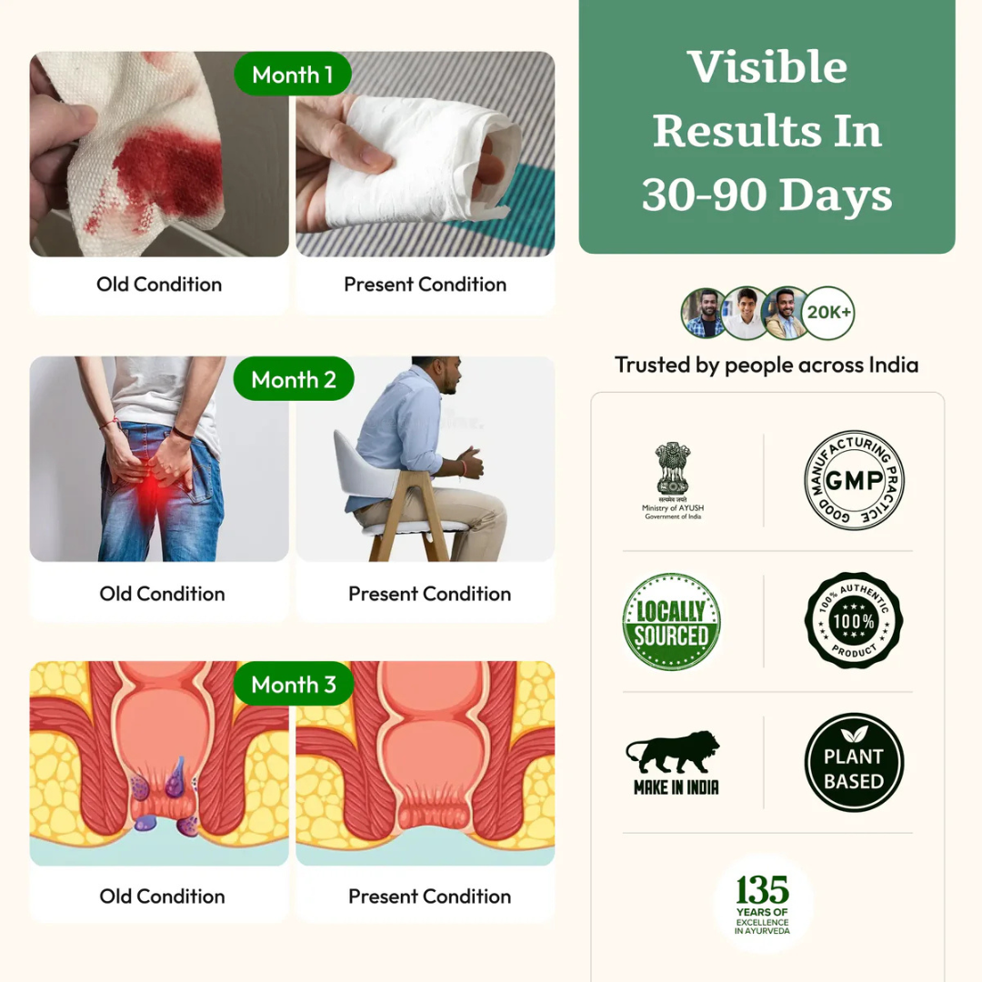 Desi ved Piles Care, 100% Ayurvedic Pilexo Plus, 30+ Years Expertise